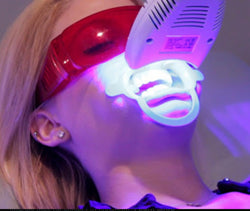 Professional teeth whitening service