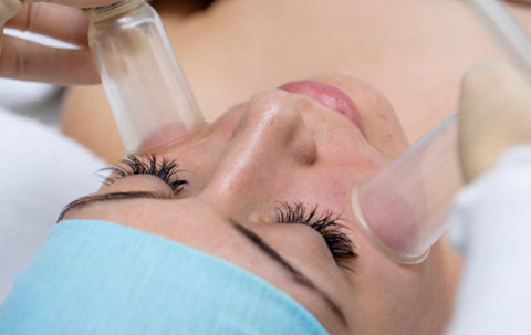 Facial Cupping treatment