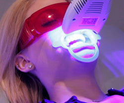 Teeth whitening w/maintenance kit