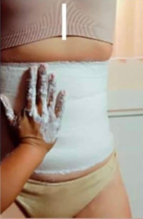 Stomach Fat Wrap -  Canada